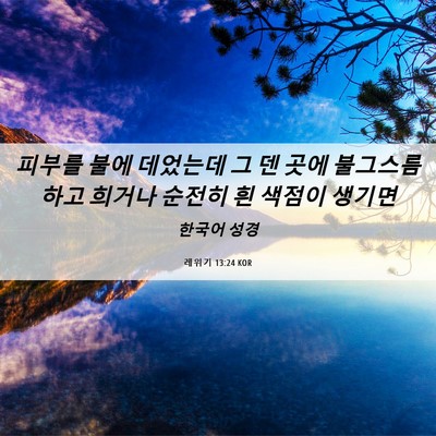 Picture 06 - 레위기 13:24 KOR - 피부를 불에 데었는데 그 덴 곳에 - Bible Verse Picture